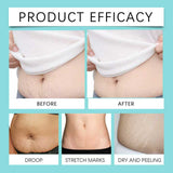 Collagen Stretch Mark Removal Oil